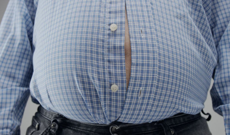 La obesidad es un problema grave de salud.